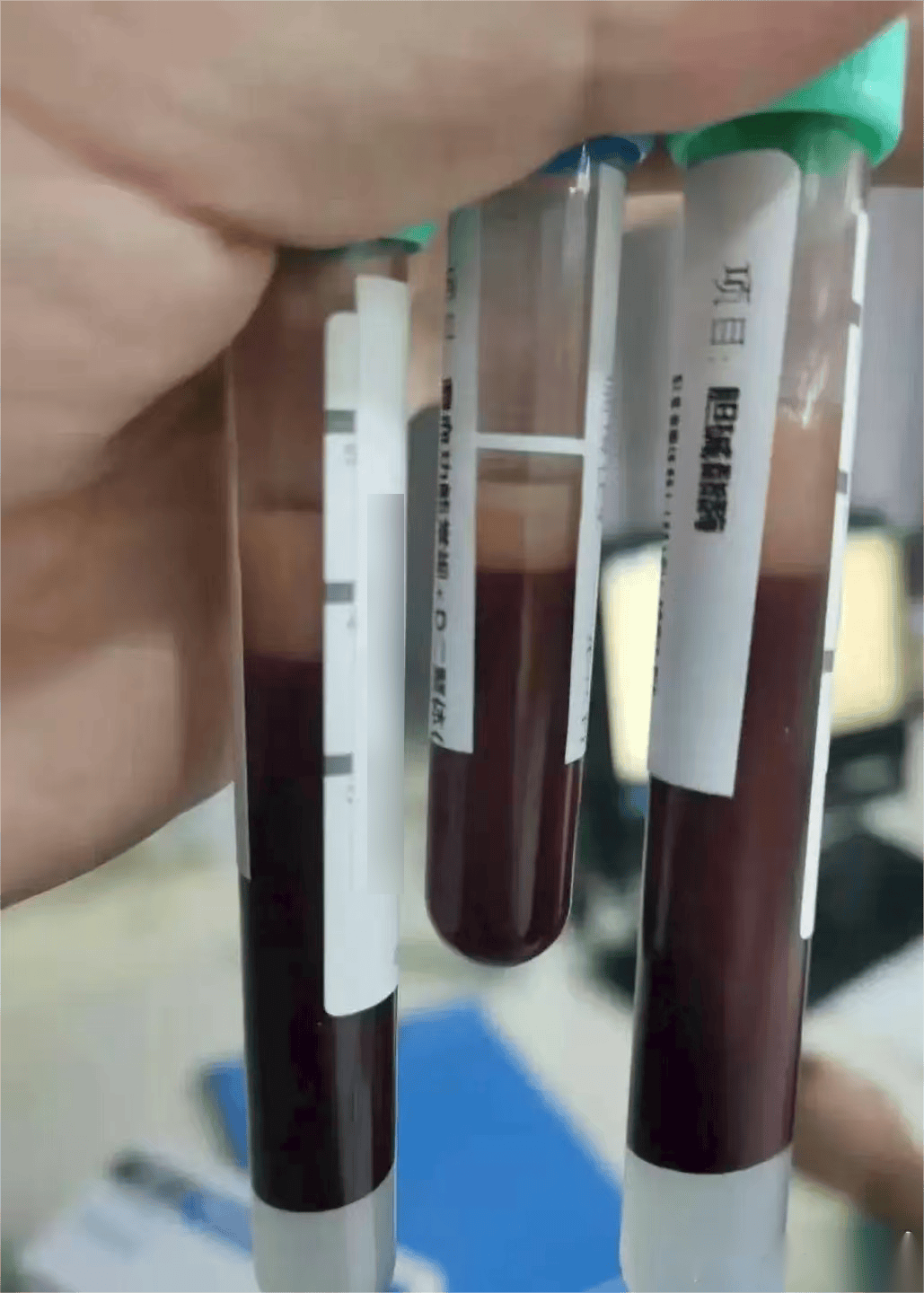 茅利塔尼亚vs多哥比賽_一口气干掉5只茅利塔尼亚vs多哥比賽，宁波男子被连夜送急诊！正大量上市！医生提醒：一次别超过2只